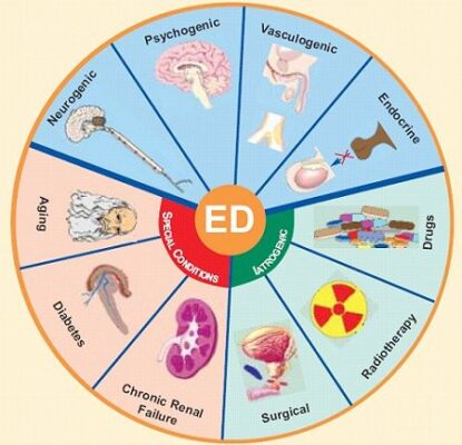 Causes-of-Erectile-Dysfunction-ED-Treament